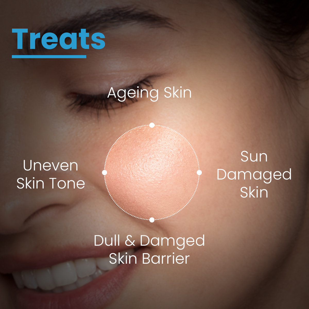 Fixderma C Scape 25 Serum, 30 ml, Pack of 1 Fixderma C Scape 25 Serum, 30 ml, Pack of 1