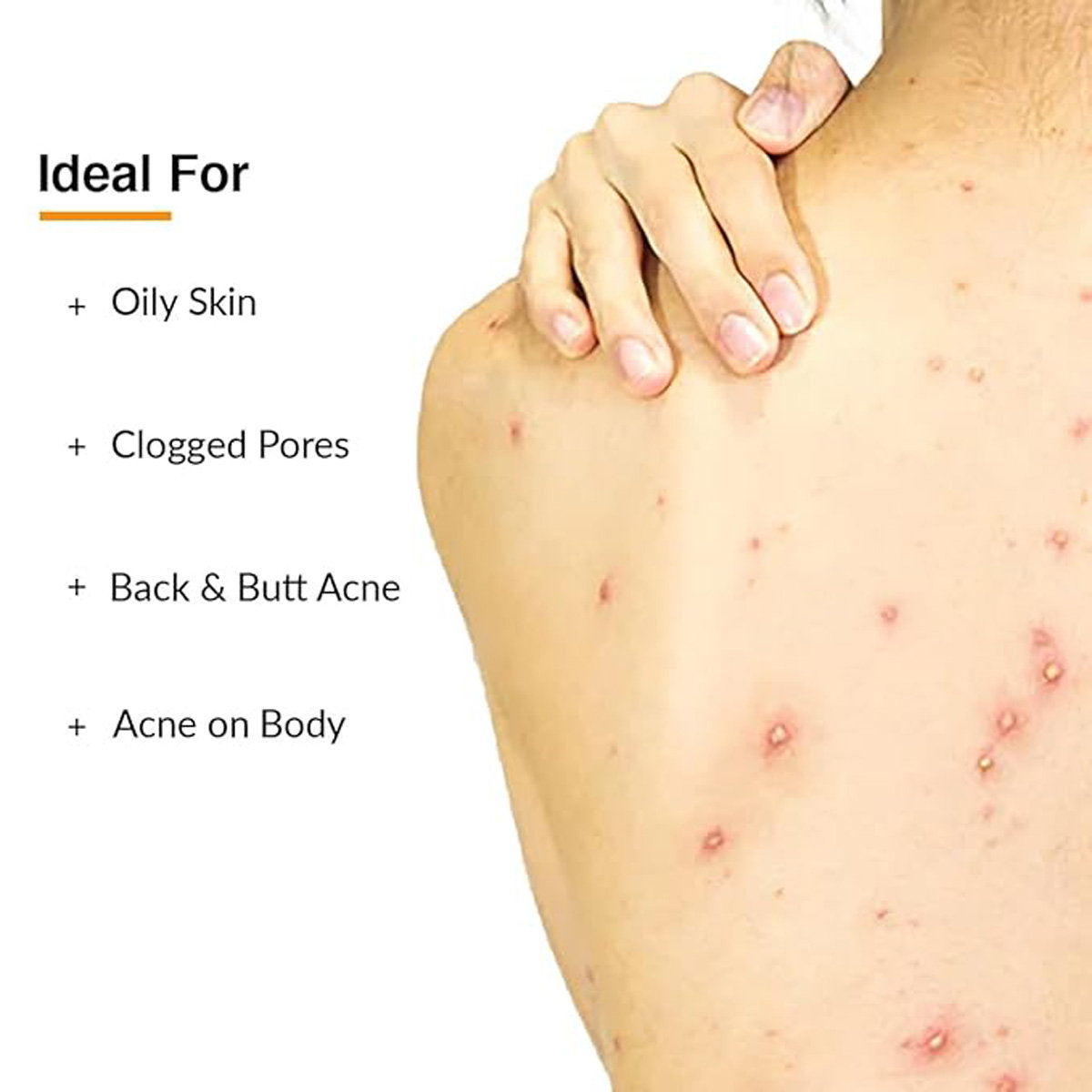 Fixderma Salyzap Body Wash 200 ml, Pack of 1 Fixderma Salyzap Body Wash 200 ml, Pack of 1