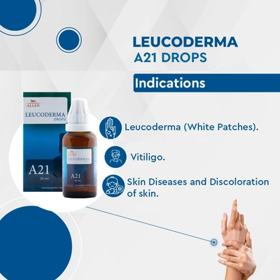 Allen A21 Leucoderma Drops, 30 ml, Pack of 1