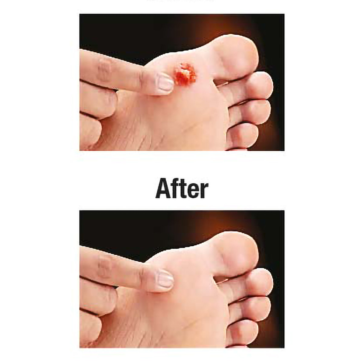 Amrutanjan Decorn, 4 Capsules, Pack of 1 Amrutanjan Decorn, 4 Capsules, Pack of 1