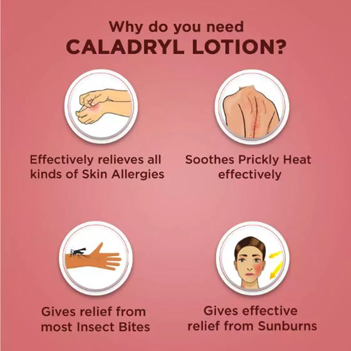 Caladryl Skin Allergy Expert Lotion 60 ml | Relieves All Kind Of Skin Allergies, Rashes, Insect Bites, Sunburns, Prickly Heat, Minor Skin Irritation, Pack of 1 Caladryl Skin Allergy Expert Lotion 60 ml | Relieves All Kind Of Skin Allergies, Rashes, Insect Bites, Sunburns, Prickly Heat, Minor Skin Irritation, Pack of 1