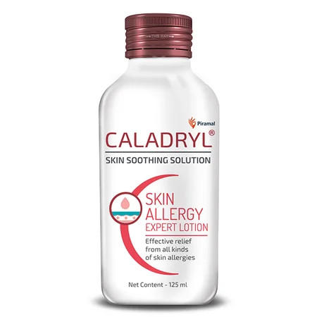 Caladryl Skin Allergy Expert Lotion 125 ml | Relieves All Kind Of Skin Allergies, Rashes, Insect Bites, Sunburns, Prickly Heat, Minor Skin Irritation