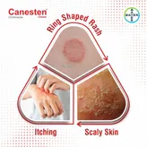 Canesten Cream 30 gm, Pack of 1 CREAM