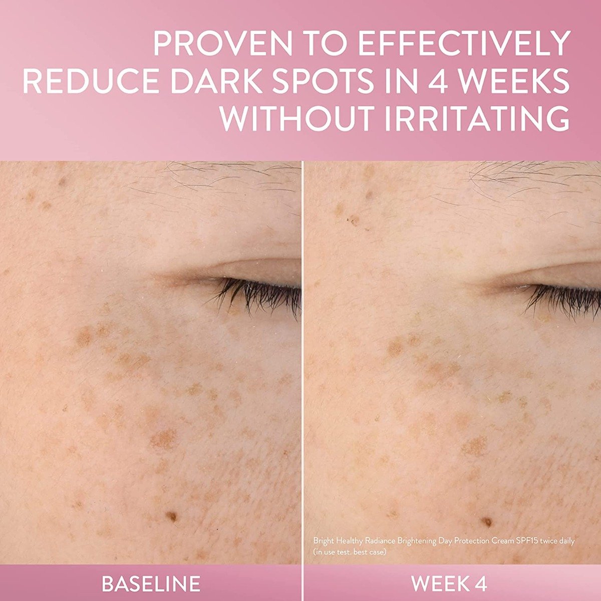 Cetaphil Brightness Reveal Creamy Cleanser 100 gm | Gentle Bright Technology | Cleanses Impurities | Deliver Radiant & Luminous Skin, Pack of 1 Cetaphil Brightness Reveal Creamy Cleanser 100 gm | Gentle Bright Technology | Cleanses Impurities | Deliver Radiant & Luminous Skin, Pack of 1