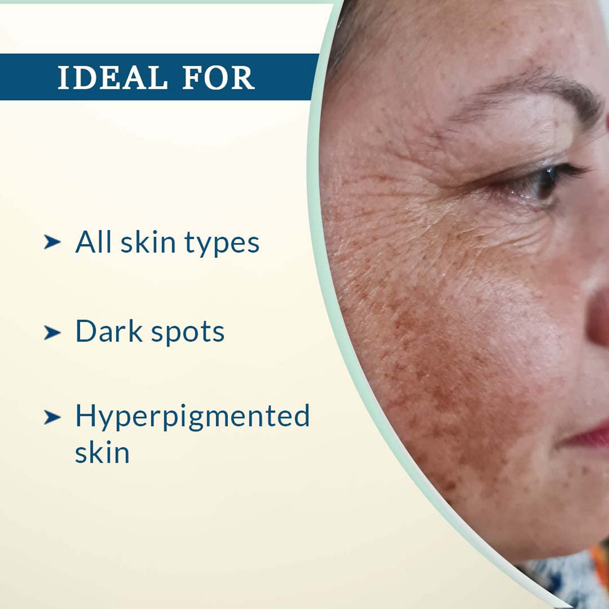 Fixderma C Scape 25 Serum 30 Ml, Pack of 1 Fixderma C Scape 25 Serum 30 Ml, Pack of 1