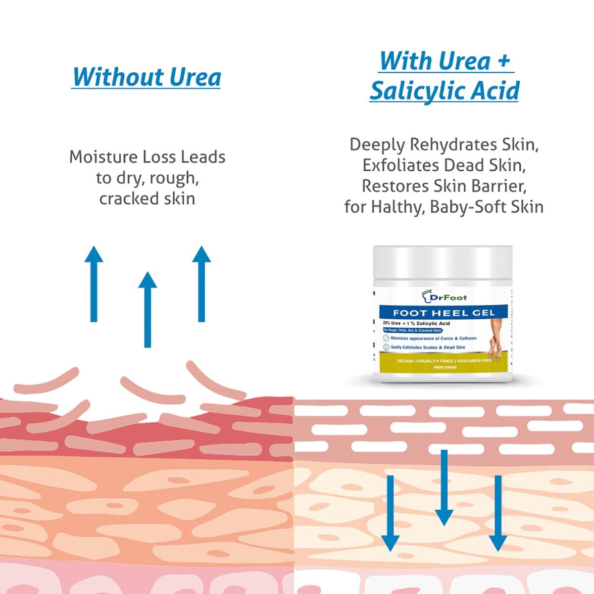 Dr Foot Foot Heel Gel 100 gm | Urea & Salicyic Acid | Gently Exfoliates Dead Cells & Scales | Reduces Corn & Calluses | For Rough, Thick, Dry & Cracked Feet, Pack of 1 Dr Foot Foot Heel Gel 100 gm | Urea & Salicyic Acid | Gently Exfoliates Dead Cells & Scales | Reduces Corn & Calluses | For Rough, Thick, Dry & Cracked Feet, Pack of 1