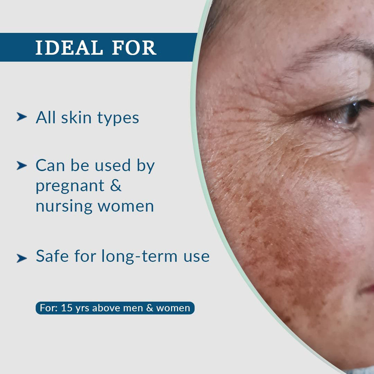 FCL Aha Lightening Gel HQ 30 ml Price, Uses, Side Effects, Composition