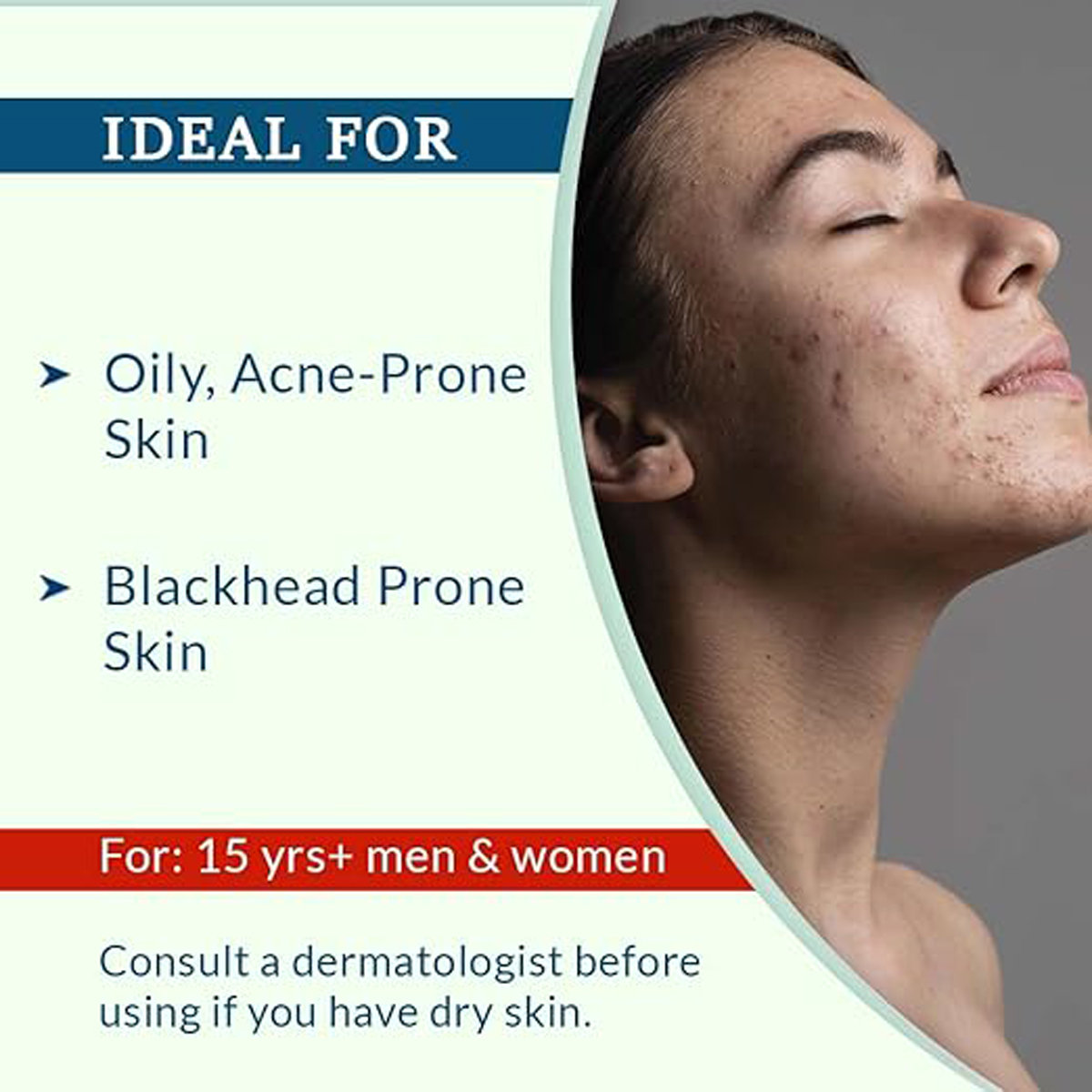 Fixderma Alpha Beta Acne Cleanser 200 ml, Pack of 1 Fixderma Alpha Beta Acne Cleanser 200 ml, Pack of 1