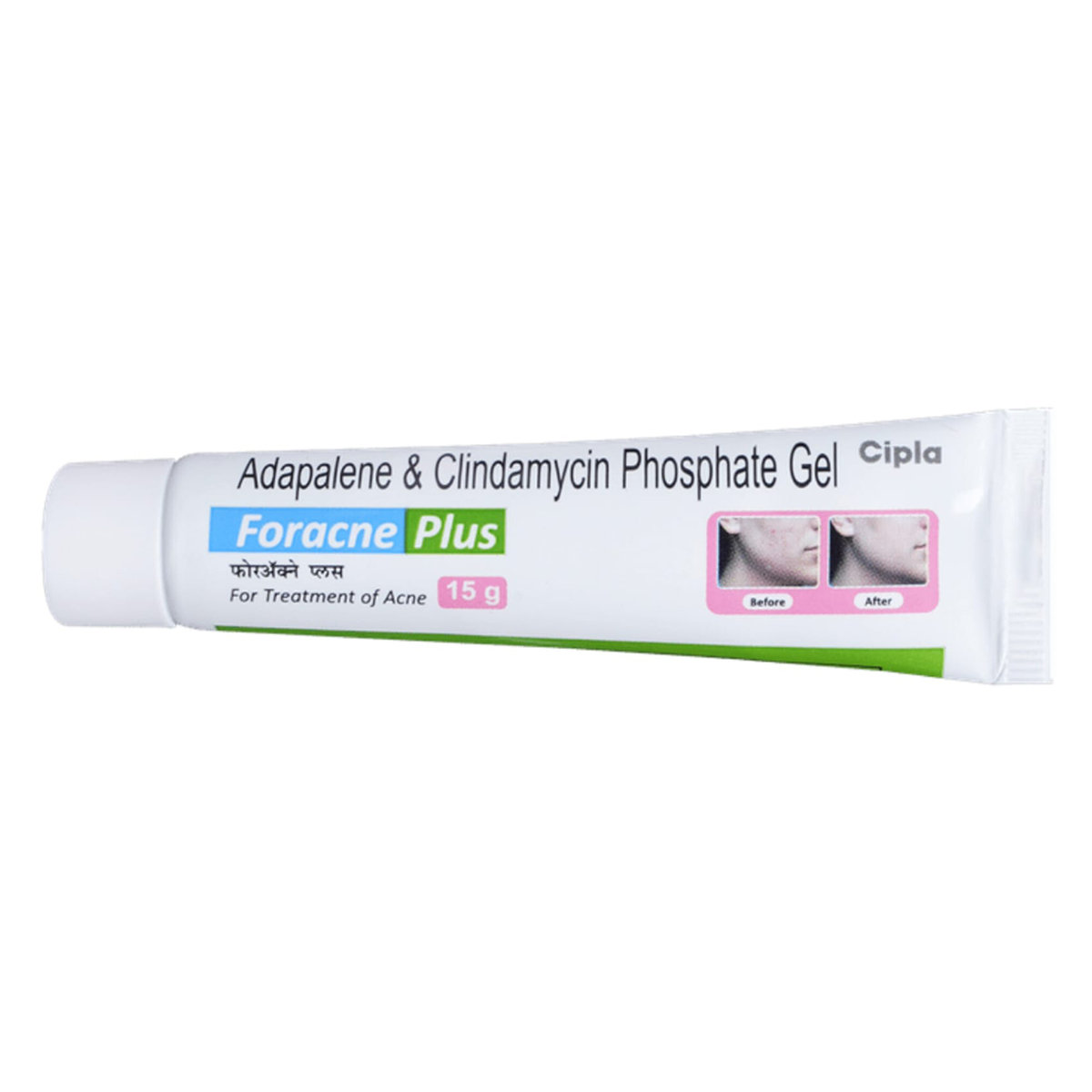 Foracne Plus Gel 15 gm, Pack of 1 Gel Foracne Plus Gel 15 gm, Pack of 1 Gel