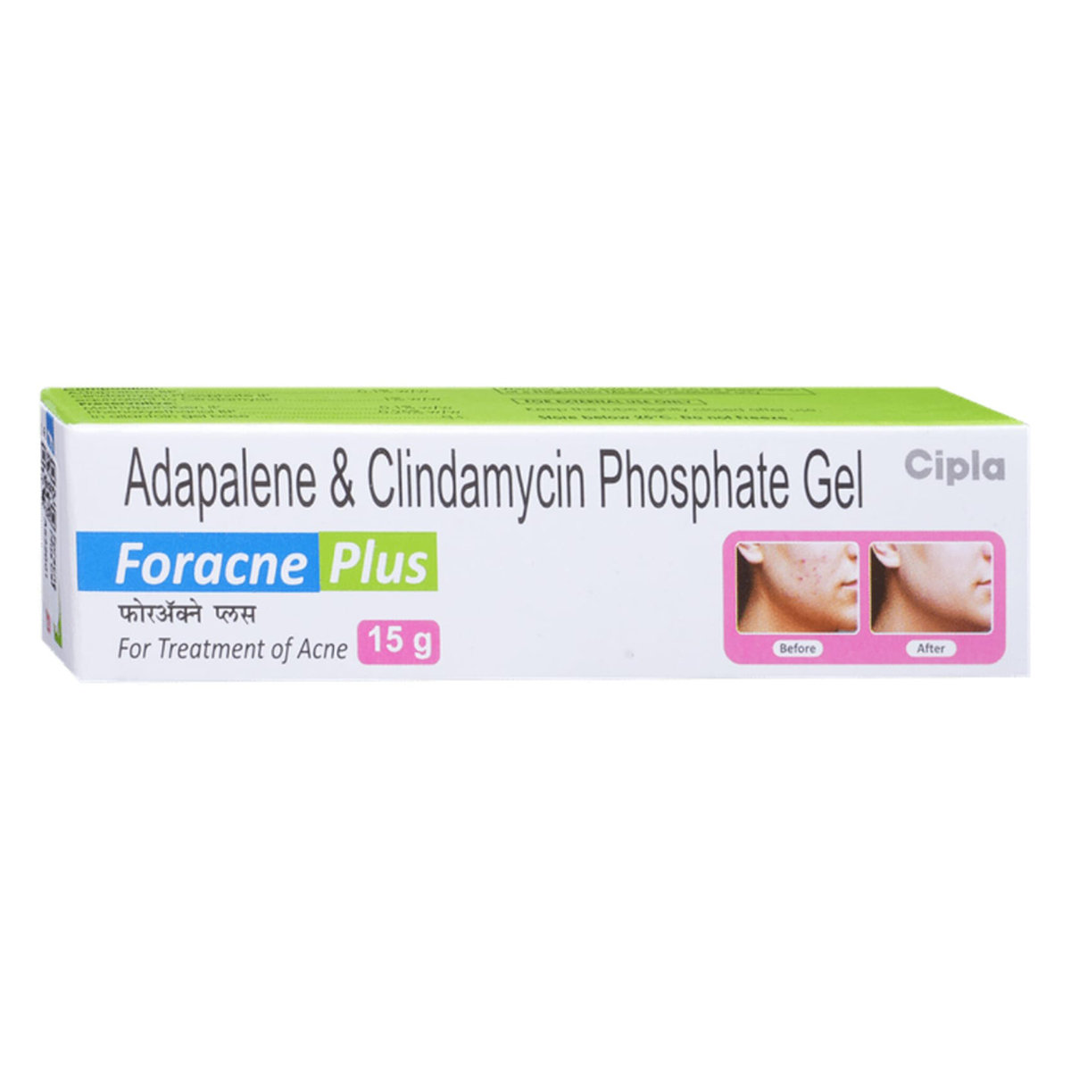 Foracne Plus Gel 15 gm, Pack of 1 Gel Foracne Plus Gel 15 gm, Pack of 1 Gel