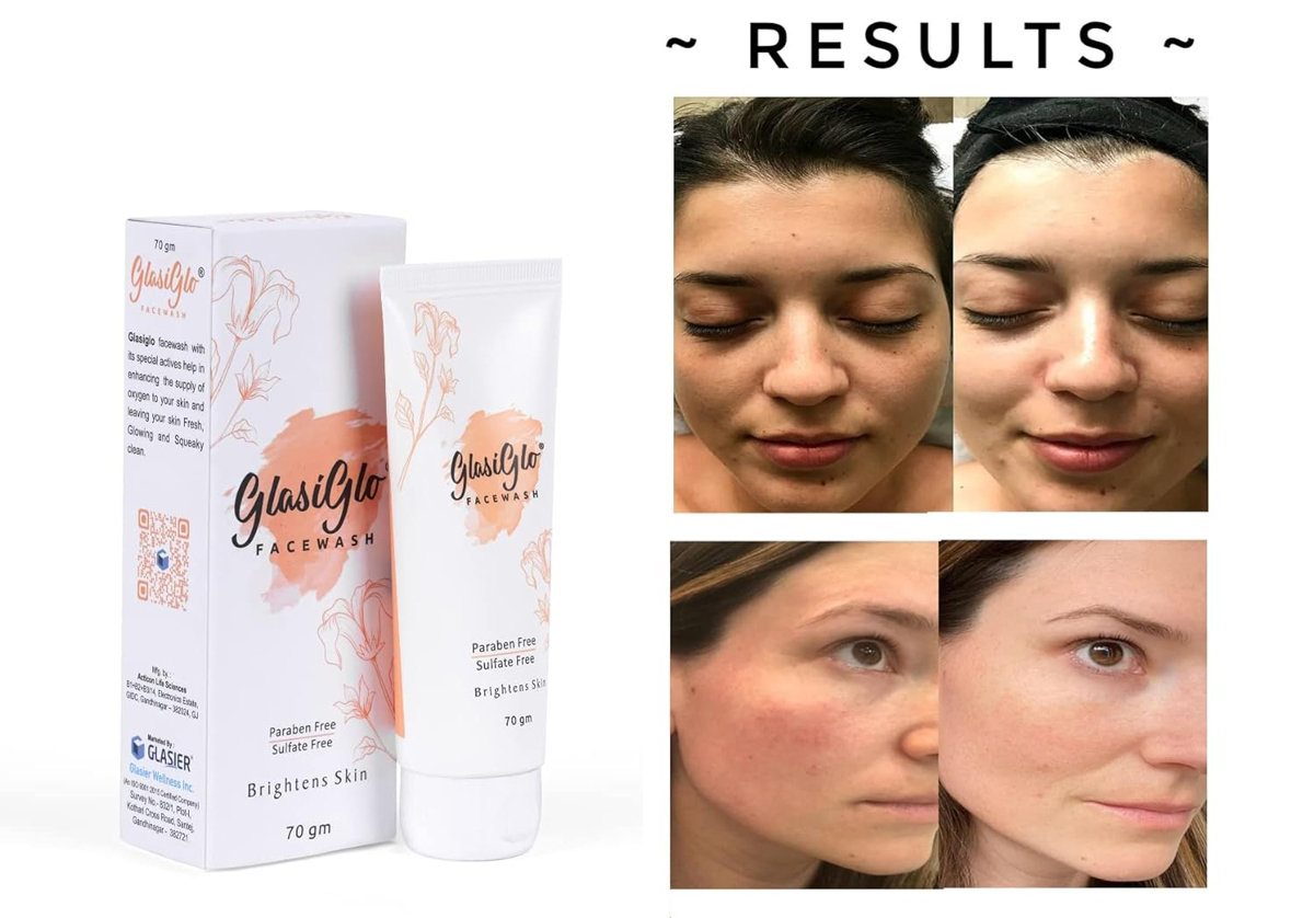 Glasiglo Face Wash 70 gm, Pack of 1 Glasiglo Face Wash 70 gm, Pack of 1