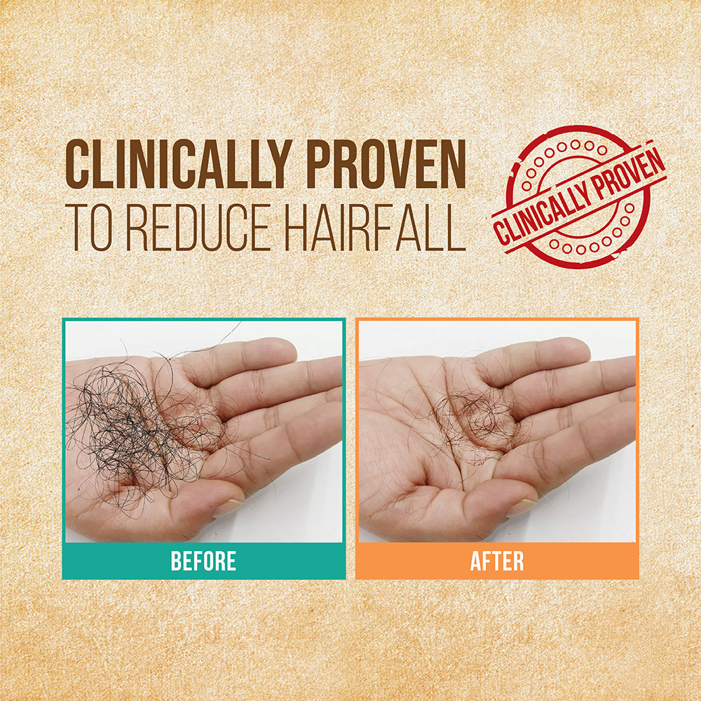 Indulekha Bringha Hair Oil, 100 ml, Pack of 1 Indulekha Bringha Hair Oil, 100 ml, Pack of 1