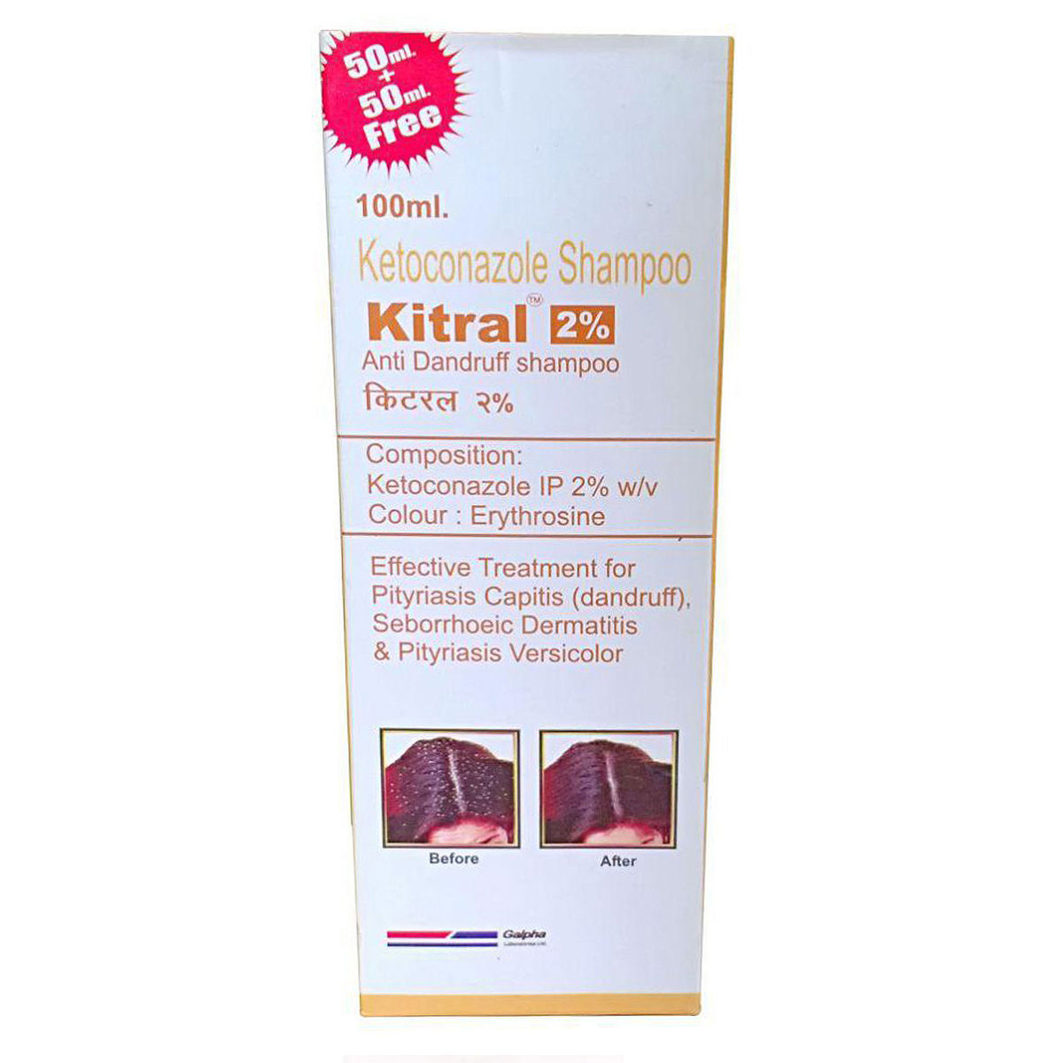 Kitral 2% Anti Dandruff Shampoo, 100 ml, Pack of 1 