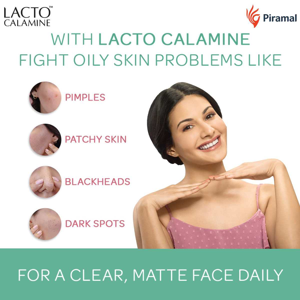Lacto Calamine Face Lotion 60 ml | Kaolin Clay & Aloe Vera | Absorbs Excess Oil | Fights Dark Spots, Blackheads & Pimples | For Combination to Normal Skin, Pack of 1 Lacto Calamine Face Lotion 60 ml | Kaolin Clay & Aloe Vera | Absorbs Excess Oil | Fights Dark Spots, Blackheads & Pimples | For Combination to Normal Skin, Pack of 1