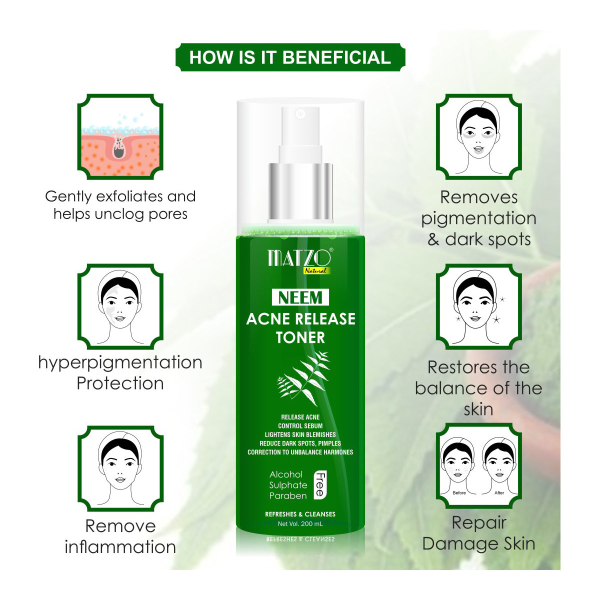 Matzo Neem Acne Release Toner 200 ml | Cleanses & Refreshes | Controls Excess Oil | Reduces Dark Spots, Pimples & Blemishes | 100% Natural | For Men & Women, Pack of 1 Matzo Neem Acne Release Toner 200 ml | Cleanses & Refreshes | Controls Excess Oil | Reduces Dark Spots, Pimples & Blemishes | 100% Natural | For Men & Women, Pack of 1