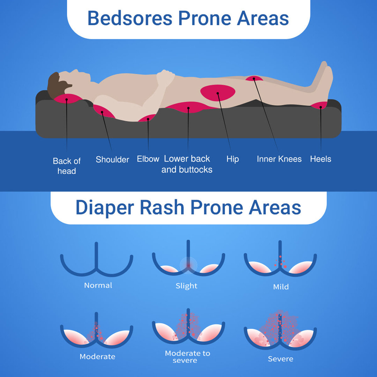 Soreze Spray 50 ml, Pack of 1 Soreze Spray 50 ml, Pack of 1