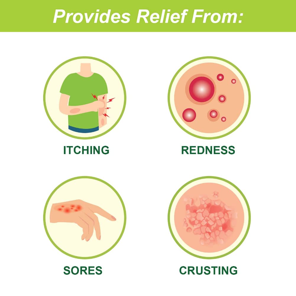 Tetmosol Soap 75 gm | 5%w/w Monosulfiram | Relieves Itching, Redness, Sore & Crusting | Fights Skin Infections, Pack of 1 Tetmosol Soap 75 gm | 5%w/w Monosulfiram | Relieves Itching, Redness, Sore & Crusting | Fights Skin Infections, Pack of 1