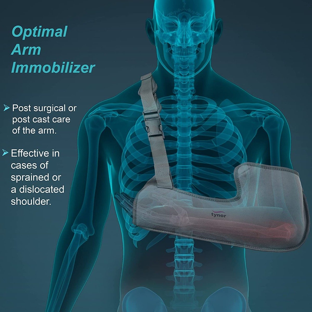 Tynor Arm Sling Tropical Pouch Medium, 1 Count, Pack of 1 Tynor Arm Sling Tropical Pouch Medium, 1 Count, Pack of 1