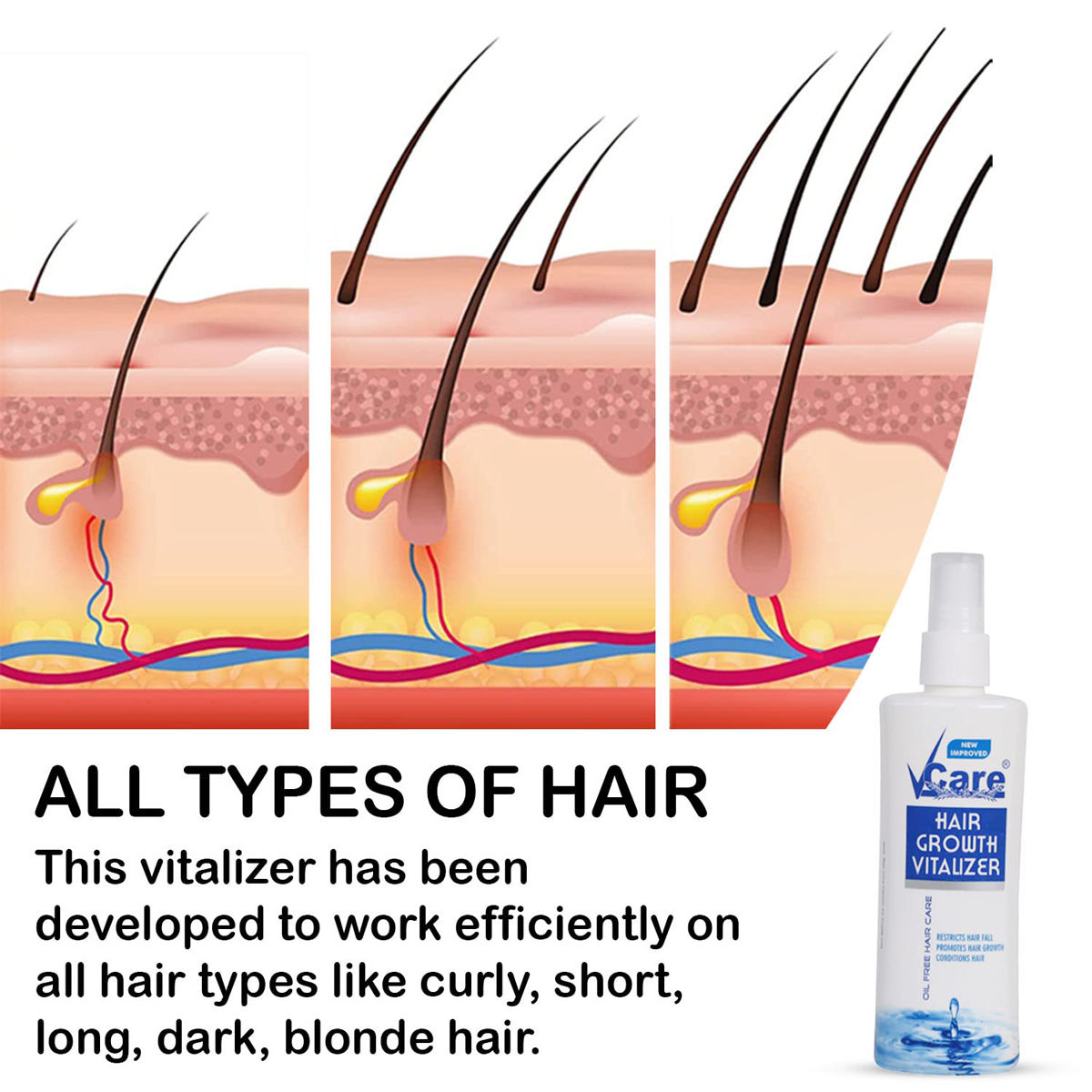 V-Care Hair Growth Vitalizer, 100 ml Price, Uses, Side Effects 