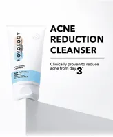 Novology Acne Reduction Cleanser, 150 gm, Pack of 1