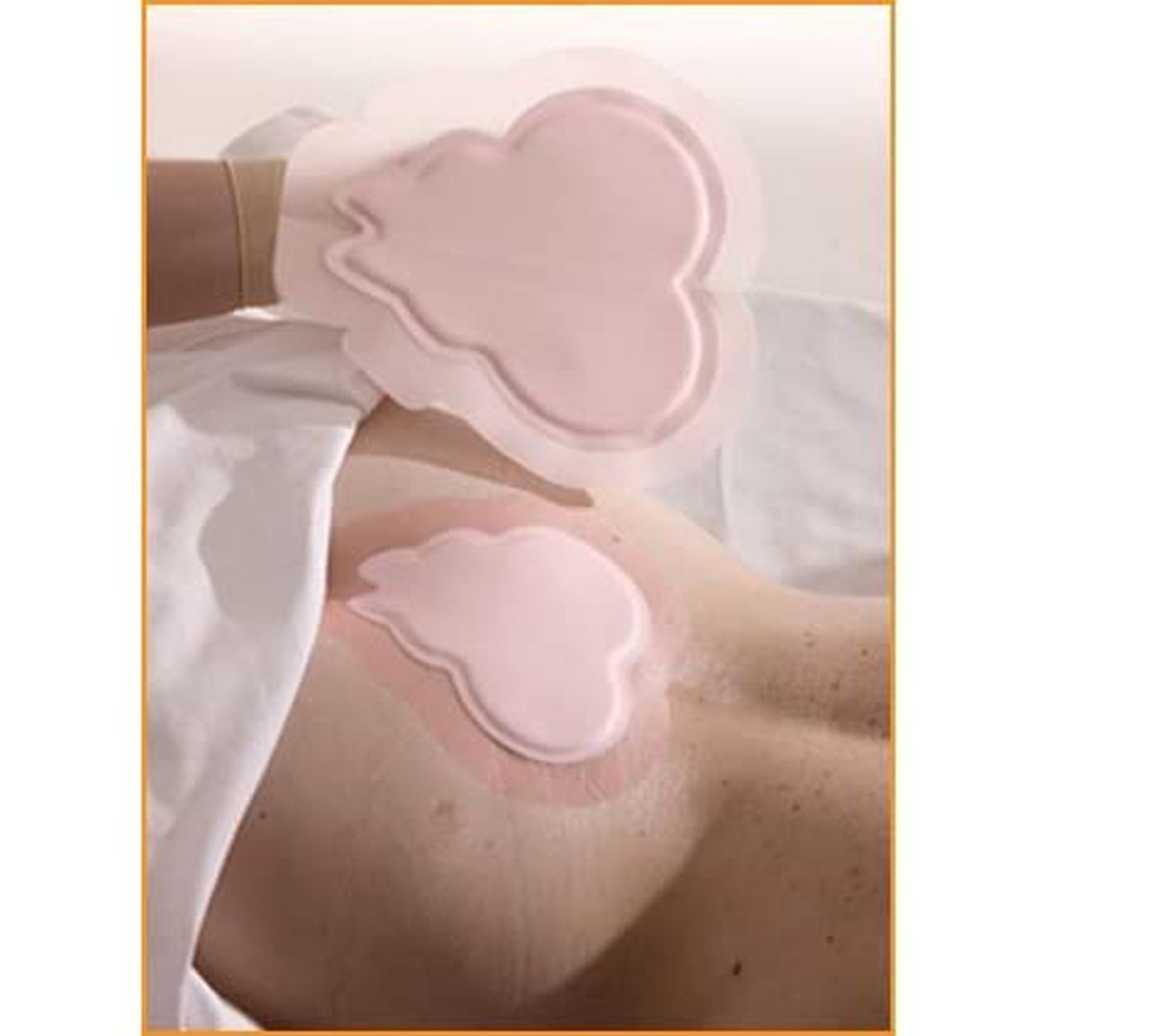 Allevyn Sacrum Dressing 17cm x 17cm, 1 Count, Pack of 1 Allevyn Sacrum Dressing 17cm x 17cm, 1 Count, Pack of 1