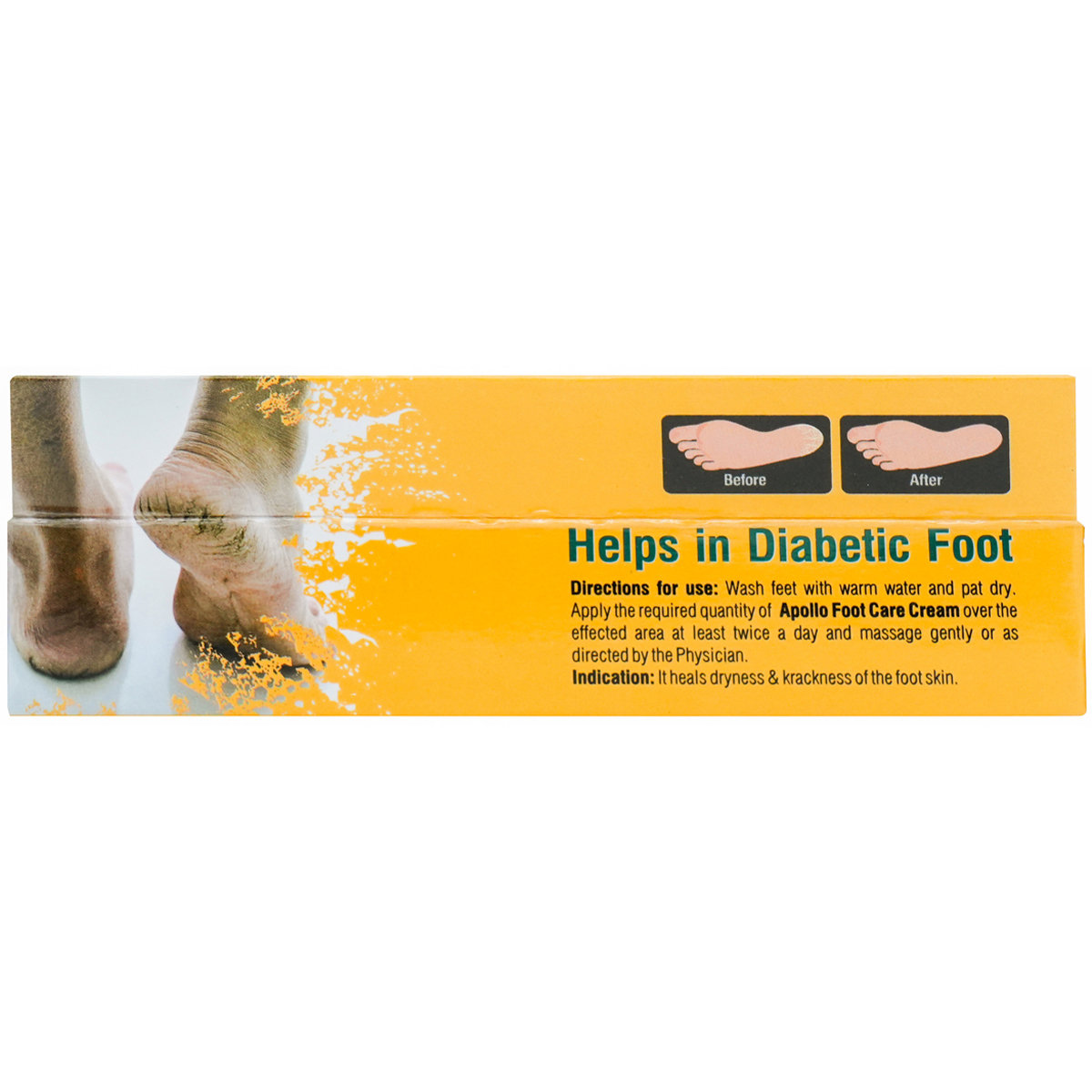 Apollo Life Diabetic Foot Care Cream, 30 gm, Pack of 1 Apollo Life Diabetic Foot Care Cream, 30 gm, Pack of 1