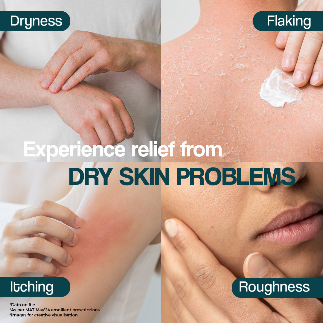 Venusia Max Intensive Moisturizing Cream 150 gm | With Unique Combination Of Butters | Long Lasting Moisturization | Non Greasy | For Dry To Very Dry Skin, Pack of 1 Venusia Max Intensive Moisturizing Cream 150 gm | With Unique Combination Of Butters | Long Lasting Moisturization | Non Greasy | For Dry To Very Dry Skin, Pack of 1