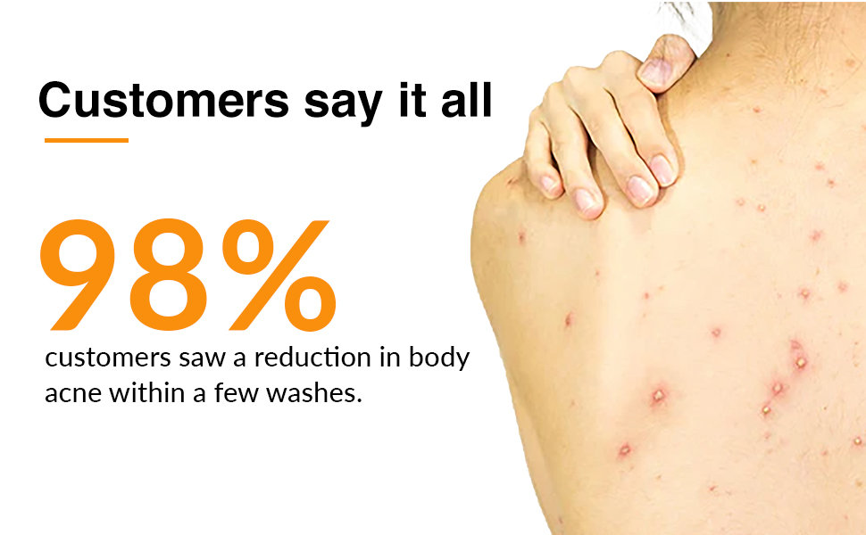 Fixderma Salyzap Body Wash 200 ml, Pack of 1 Fixderma Salyzap Body Wash 200 ml, Pack of 1