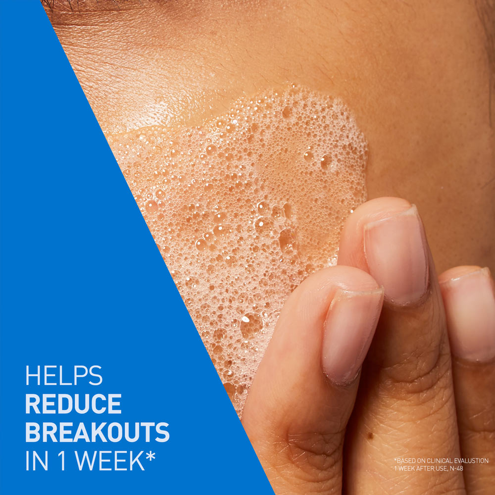 CeraVe Blemish Control Cleanser 236 ml | with 2% Salicylic Acid & Niacinamide for Acne-Prone Skin, Pack of 1 CeraVe Blemish Control Cleanser 236 ml | with 2% Salicylic Acid & Niacinamide for Acne-Prone Skin, Pack of 1