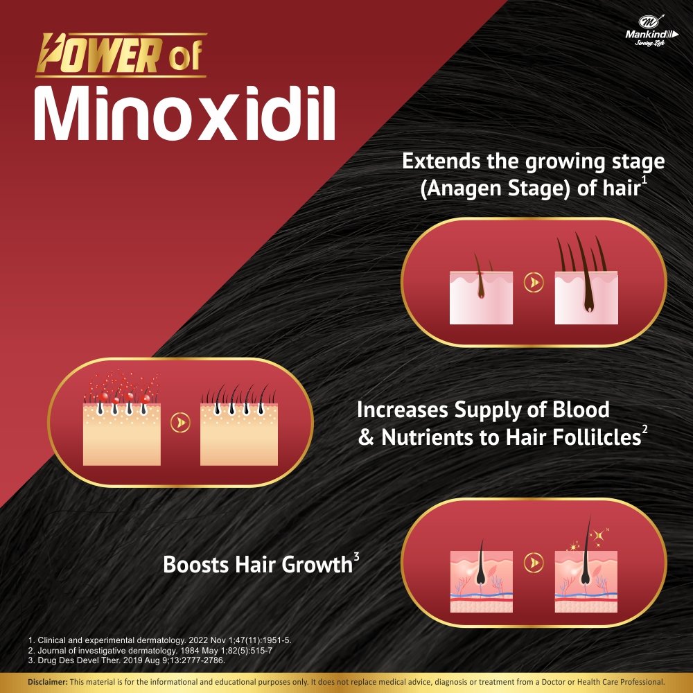 Chekfall 5% Minoxidil Solution 60 ml | Prevents Hair Loss | Alcohol Free, Pack of 1 Solution Chekfall 5% Minoxidil Solution 60 ml | Prevents Hair Loss | Alcohol Free, Pack of 1 Solution