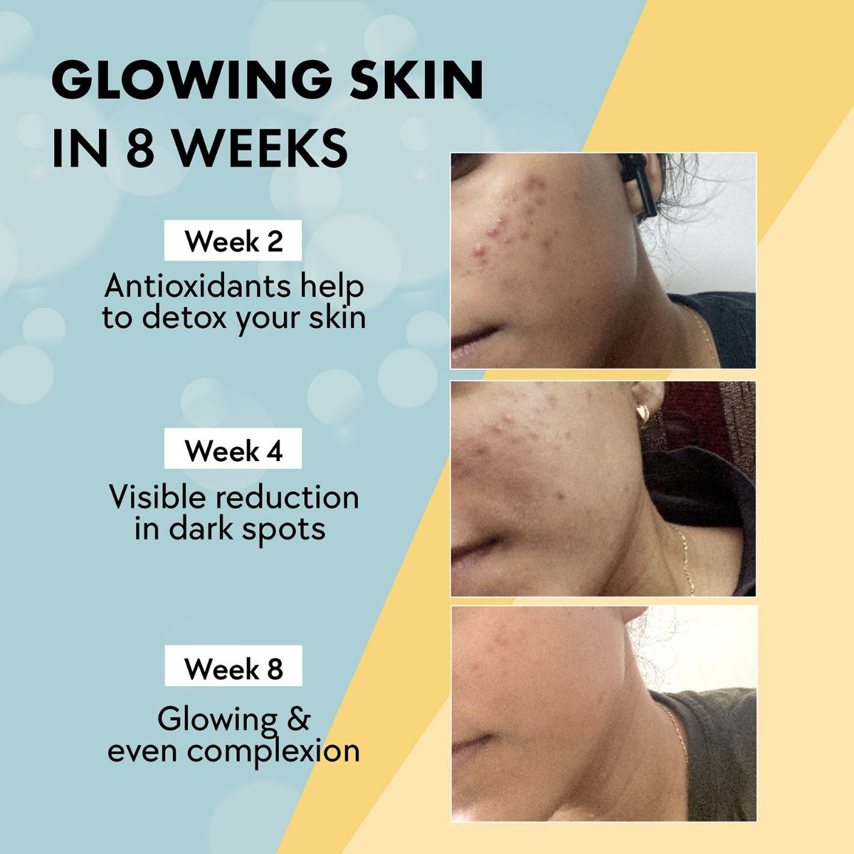 Chicnutrixglow Japanese OPITAC Glutathione, 20 Effervescent Tablets | for Clear & Glowing Skin, Pack of 1 Chicnutrixglow Japanese OPITAC Glutathione, 20 Effervescent Tablets | for Clear & Glowing Skin, Pack of 1