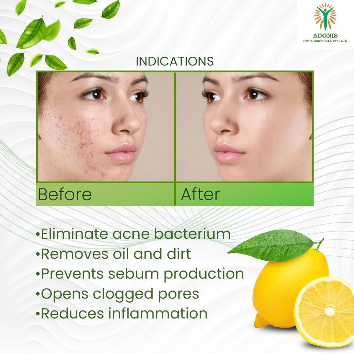 Adonis DS Acne Face Wash 100 gm | With Natural Ingredients | Removes Excess Oil | Prevents Acne Eruptions | For Acne Free Skin, Pack of 1 Adonis DS Acne Face Wash 100 gm | With Natural Ingredients | Removes Excess Oil | Prevents Acne Eruptions | For Acne Free Skin, Pack of 1