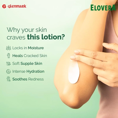 Elovera Lotion 150 ml | Aloe Vera &amp; Vitamin E | Protects &amp; Nourishes Skin | Moisturising Lotion, Pack of 1