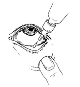 Zobra Eye Drops 5ml, Pack of 1 DROPS
