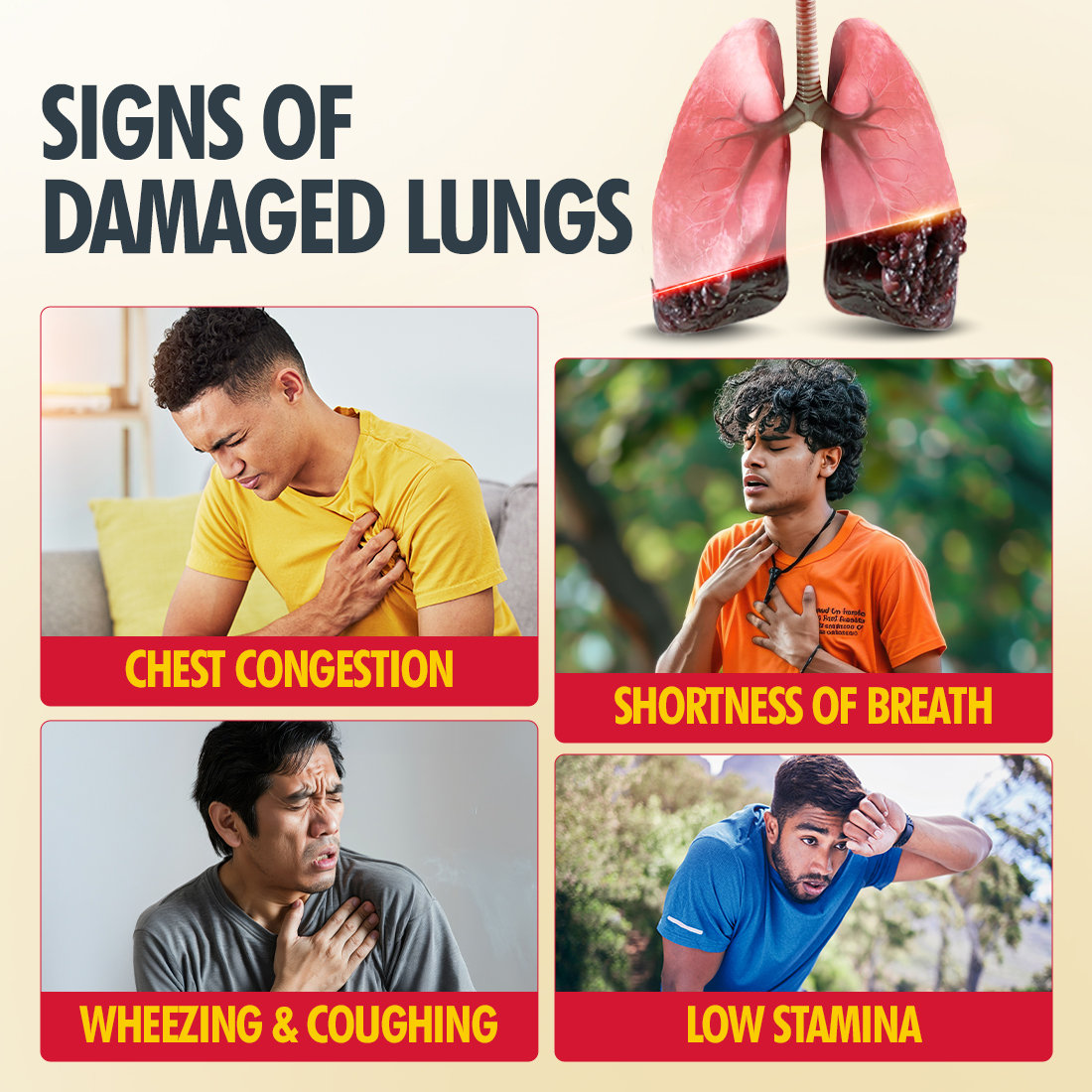 Fast&Up Lung Detox N-Acetylcysteine + Vitamin C Strawberry Flavour, 20 Effervescent Tablets | For Lung Health, Pack of 1 Fast&Up Lung Detox N-Acetylcysteine + Vitamin C Strawberry Flavour, 20 Effervescent Tablets | For Lung Health, Pack of 1