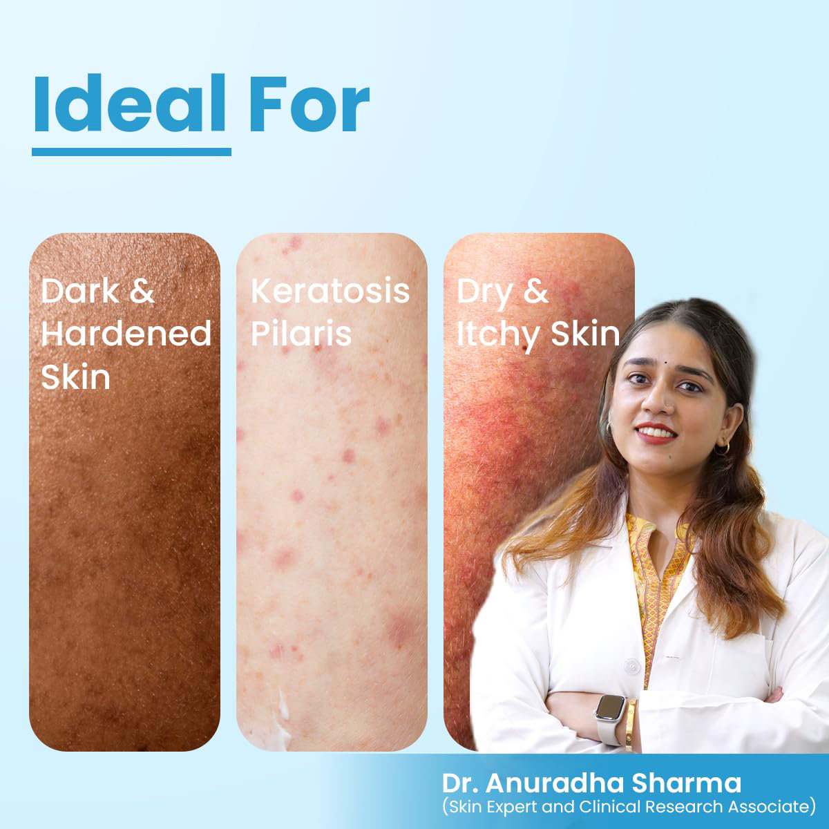 Fixderma Cosmetic Laboratories (FCL) AHA 20% Lotion, 100 ml, Pack of 1 Fixderma Cosmetic Laboratories (FCL) AHA 20% Lotion, 100 ml, Pack of 1