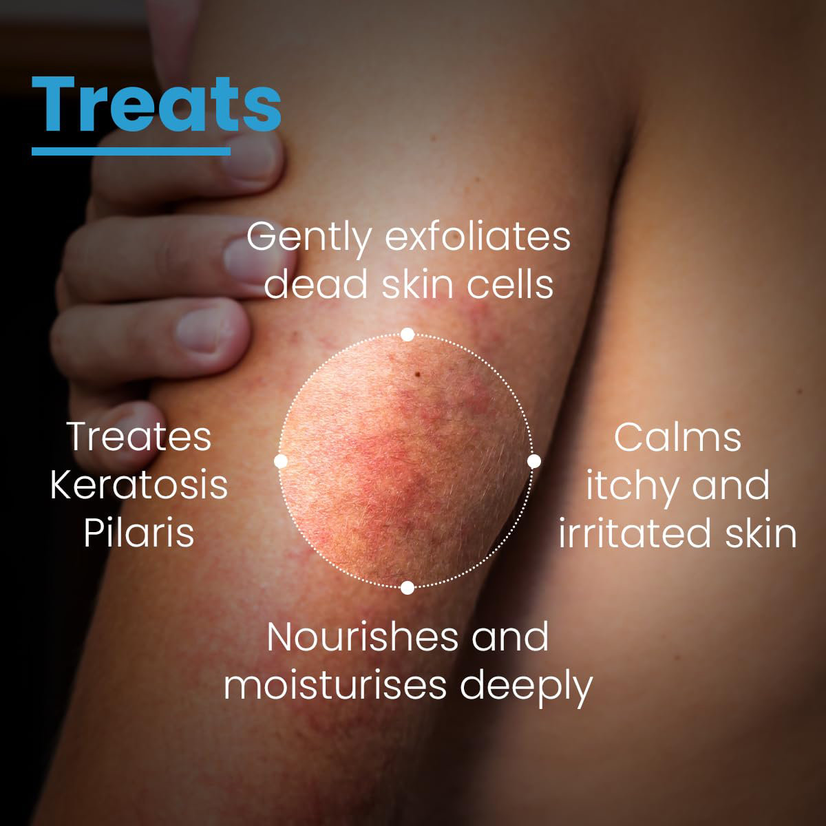 Fixderma Cosmetic Laboratories (FCL) AHA 20% Lotion, 100 ml, Pack of 1 Fixderma Cosmetic Laboratories (FCL) AHA 20% Lotion, 100 ml, Pack of 1