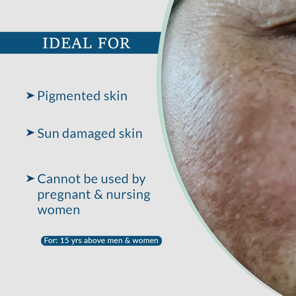 Fixderma AHA Lightening Gel HQ 15 ml, Pack of 1 Fixderma AHA Lightening Gel HQ 15 ml, Pack of 1