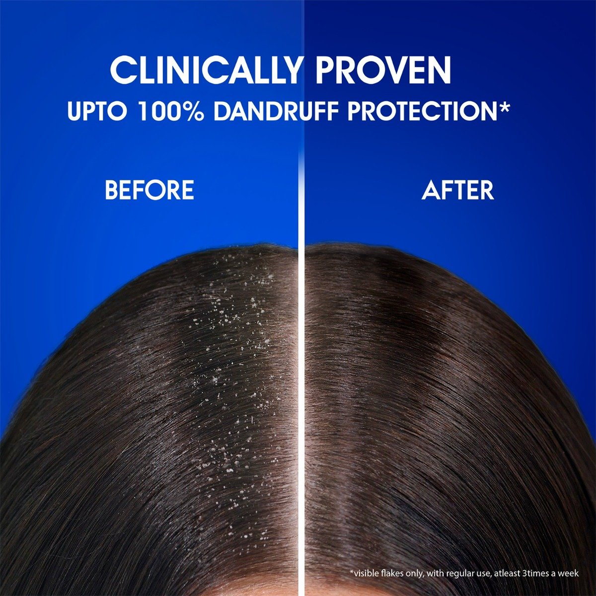 Head & Shoulders Anti-Dandruff Anti Hairfall Shampoo, 72 ml, Pack of 1 Head & Shoulders Anti-Dandruff Anti Hairfall Shampoo, 72 ml, Pack of 1