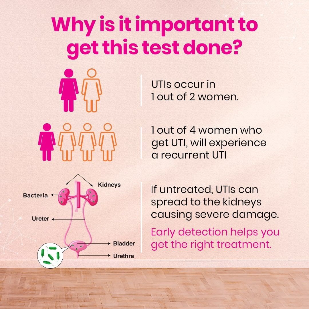 i-know UTI Testing Kit for Urinary Tract Infection, 3 Test Strips, Pack of 1 i-know UTI Testing Kit for Urinary Tract Infection, 3 Test Strips, Pack of 1
