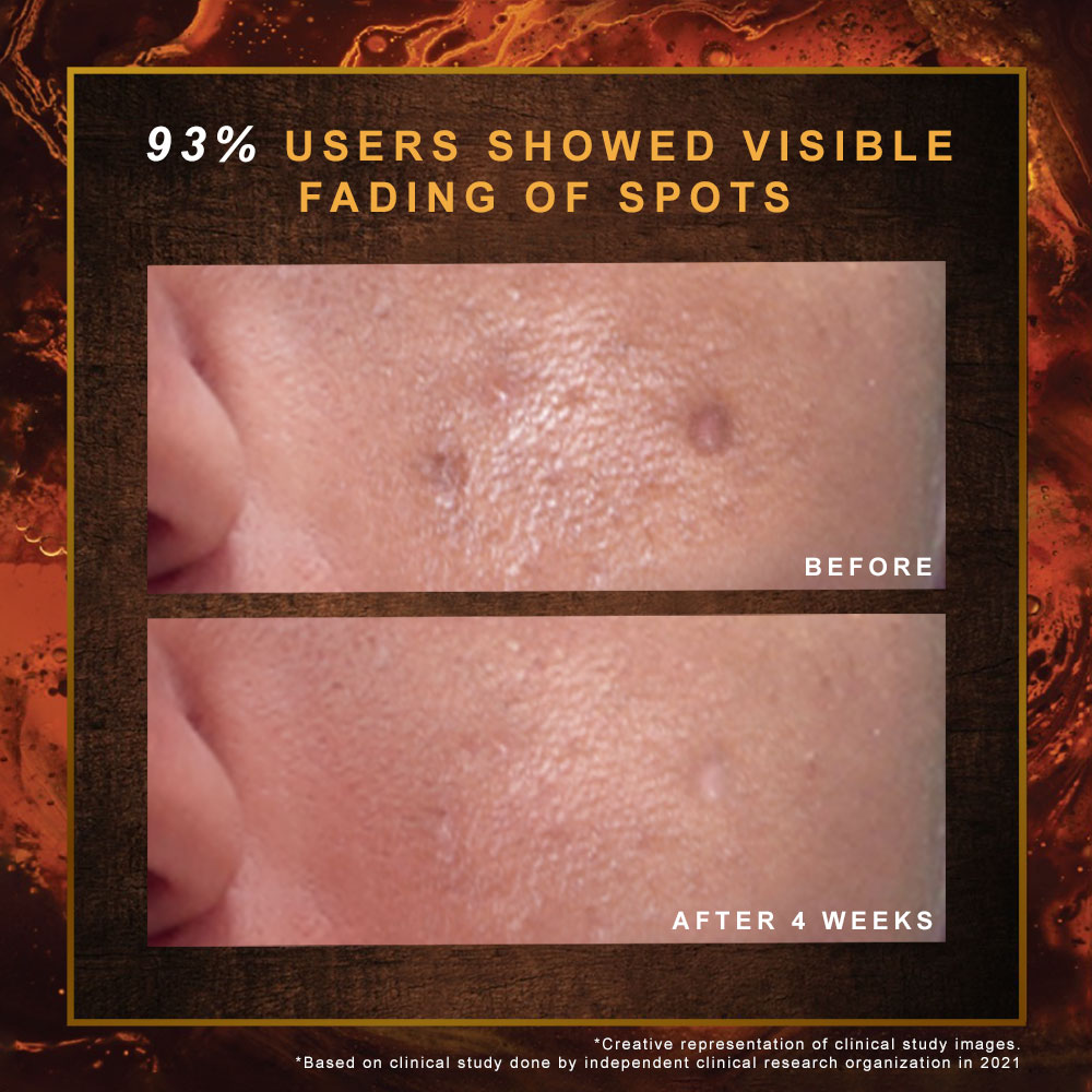 Indulekha Ayurvedic Proprietary Medicinal Soap 100 gm | Manjistha, Yashtimadhu, Matulunga, Laksha, Milk & Coconut Oil | For Dark Spots, Marks & Uneven Skin Tone, Pack of 1 Indulekha Ayurvedic Proprietary Medicinal Soap 100 gm | Manjistha, Yashtimadhu, Matulunga, Laksha, Milk & Coconut Oil | For Dark Spots, Marks & Uneven Skin Tone, Pack of 1