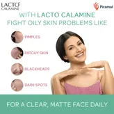 Lacto Calamine Face Care Lotion for Combination to Normal Skin, 120 ml, Pack of 1
