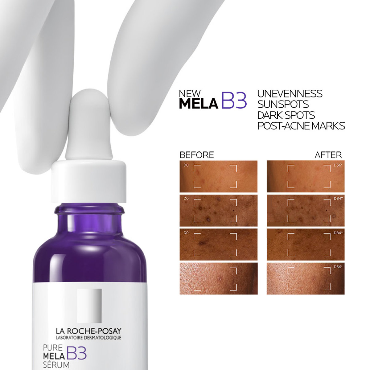 La Roche-Posay Mela B3 Face Serum, 30ml, Pack of 1 La Roche-Posay Mela B3 Face Serum, 30ml, Pack of 1