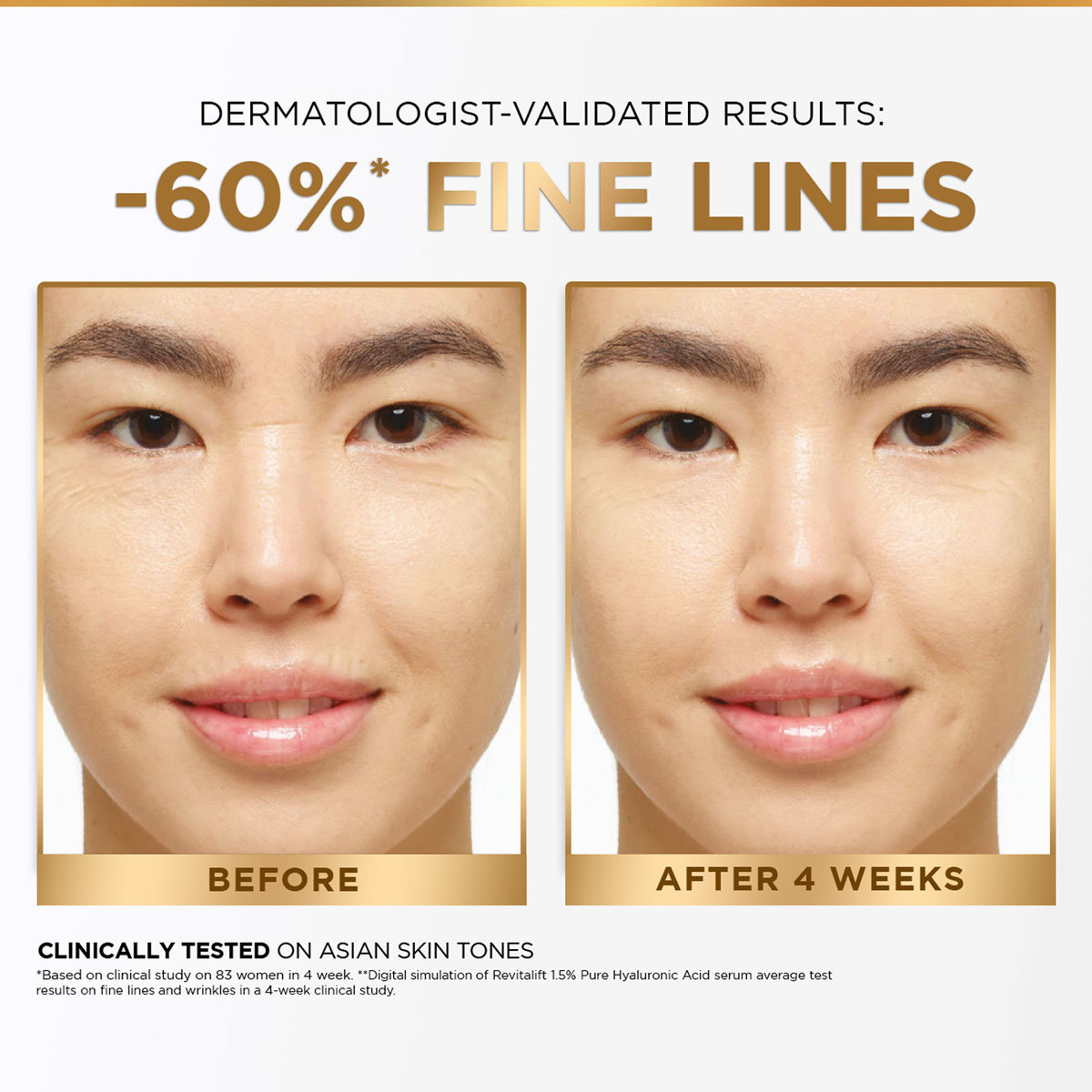 Loreal Paris Revitalift 1.5% Hyaluronic Acid Face Serum, 15 ml, Pack of 1 Loreal Paris Revitalift 1.5% Hyaluronic Acid Face Serum, 15 ml, Pack of 1