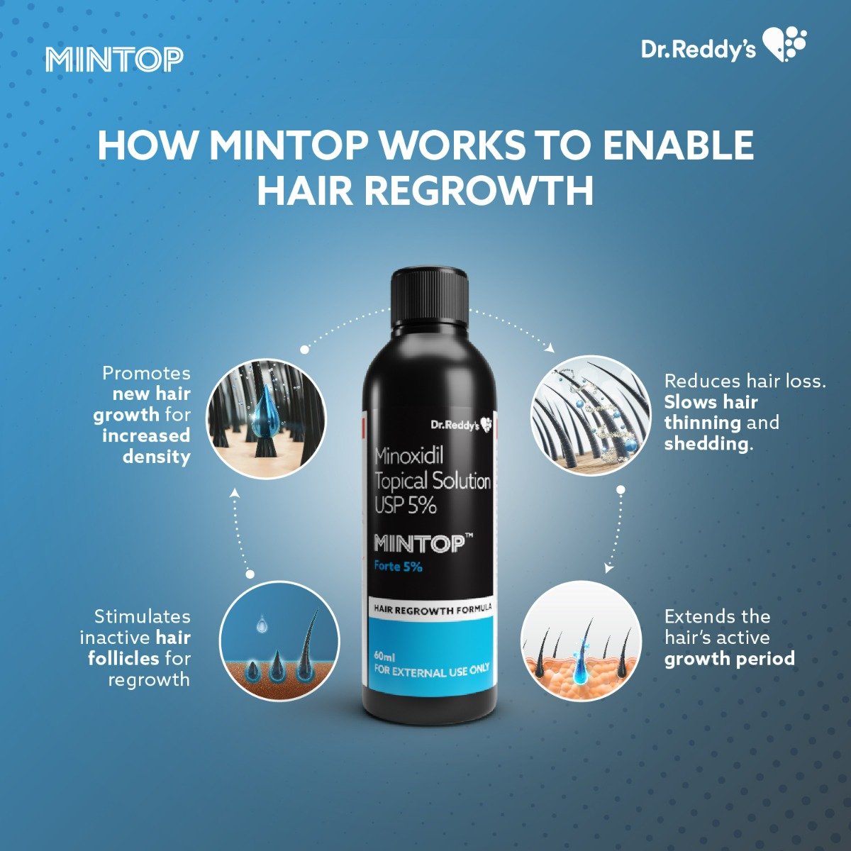 Mintop Forte 5% Solution, 60 ml, Pack of 1 Solution Mintop Forte 5% Solution, 60 ml, Pack of 1 Solution
