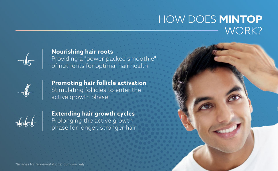 Mintop Forte 5% Solution, 60 ml, Pack of 1 Solution Mintop Forte 5% Solution, 60 ml, Pack of 1 Solution