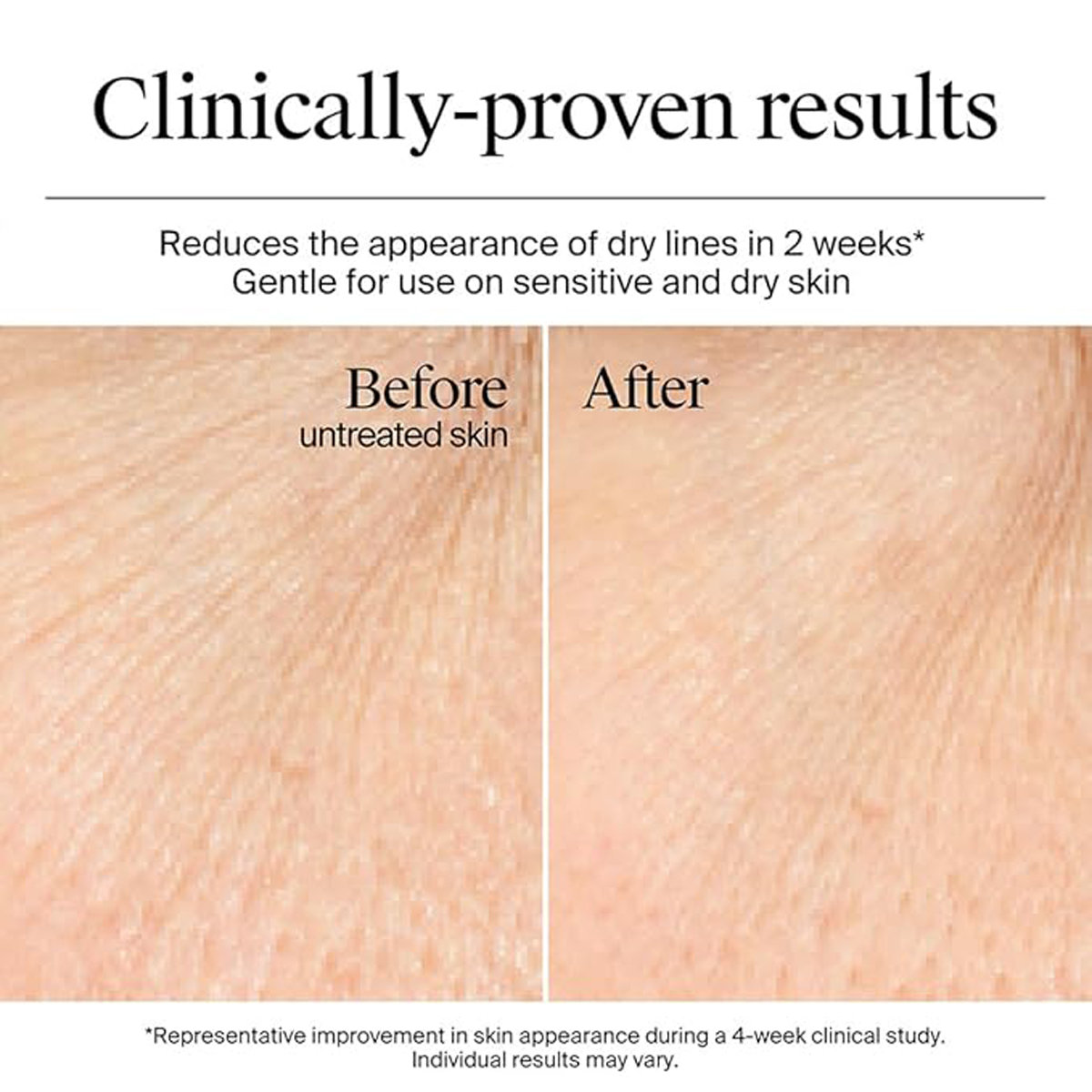 Neutrogena Hydro boost Hyaluronic Acid Night cream, 50 gm, Pack of 1 Neutrogena Hydro boost Hyaluronic Acid Night cream, 50 gm, Pack of 1