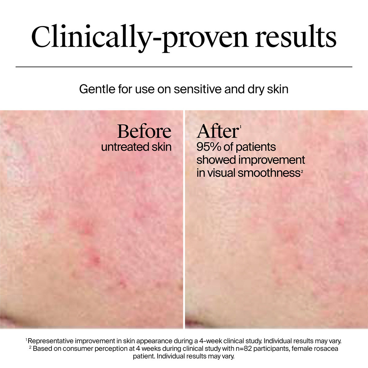 Neutrogena Hydro Boost Hyaluronic Acid Nourishing Cream, 50 gm, Pack of 1 Neutrogena Hydro Boost Hyaluronic Acid Nourishing Cream, 50 gm, Pack of 1