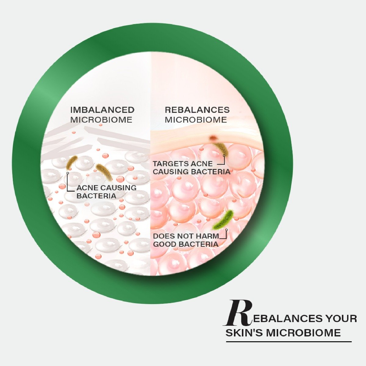 Novology Acne Clearing Serum, 28 ml, Pack of 1 Novology Acne Clearing Serum, 28 ml, Pack of 1