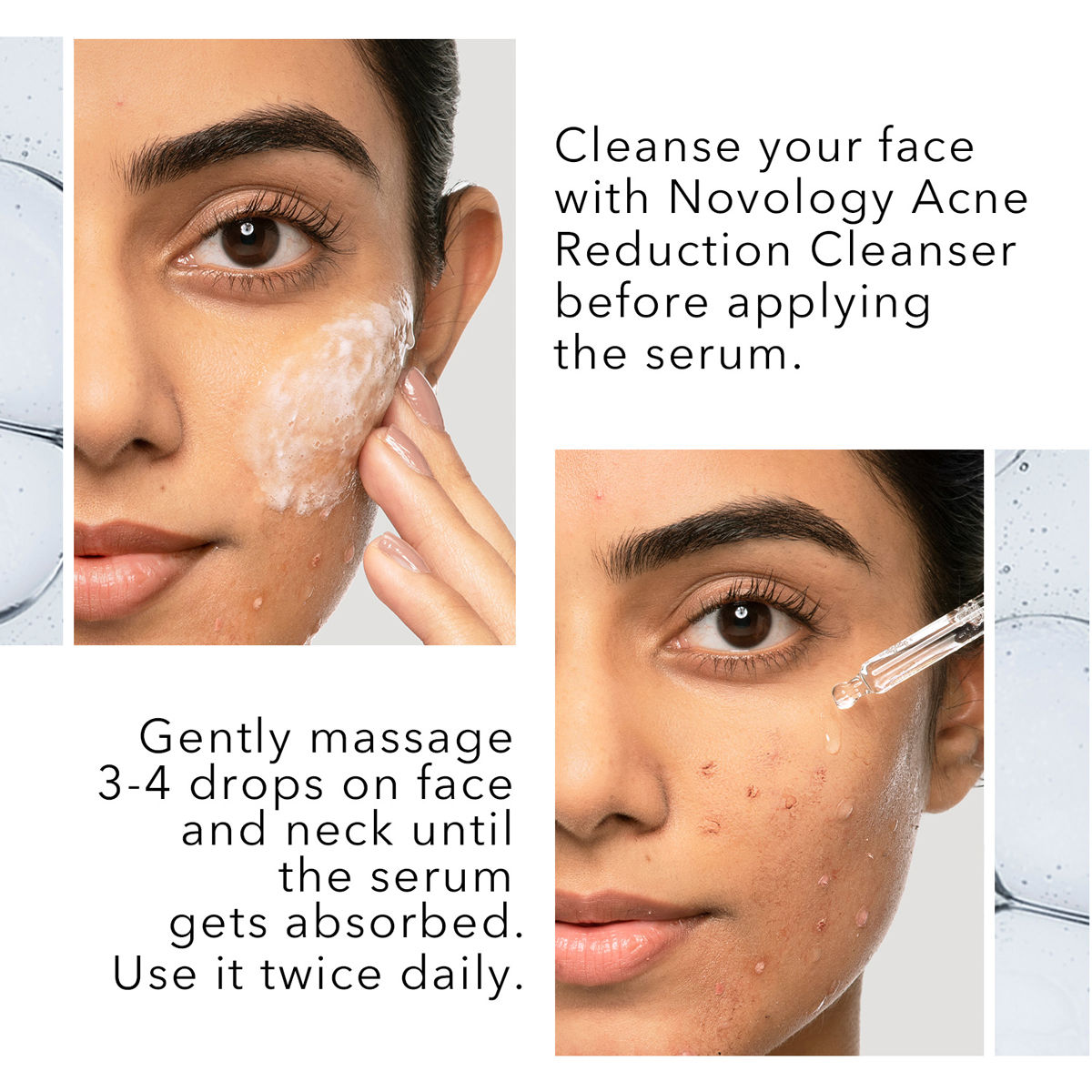 Novology Acne Reduction Serum, 28 ml Price, Uses, Side Effects ...